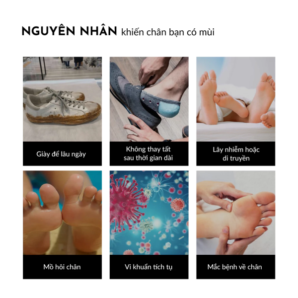 Bình Xịt Khử Mùi Hôi Chân Nano Bạc UPPER YOU Ngăn Ngừa Vi Khuẩn Giảm Tiết Mồ Hôi Hoạt Chất Tự Nhiên An Toàn - XG01 - Hình ảnh 7